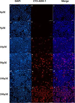 [18F]AlF-NOTA-ADH-1: A new PET molecular radiotracer for imaging of N-cadherin-positive tumors